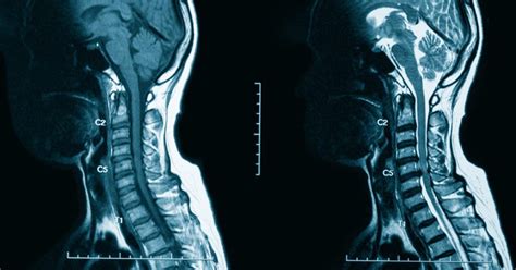 CT With Contrast and MRI With Contrast: Facts to Know • Touchstone Medical Imaging