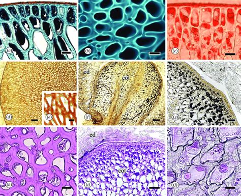 Longitudinal sections of endosperm from Smilax polyantha seeds (a-e, h)... | Download Scientific ...