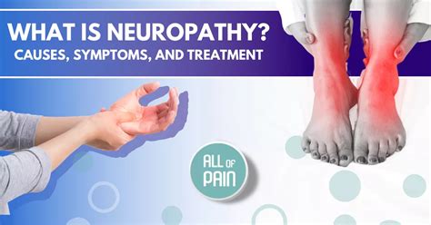 [New York Pain Management] What is Neuropathy? Causes, Symptoms, and ...