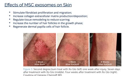 Exosomes – iSpa Consulting Inc.