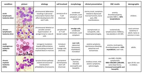 types of leukemia | Medical laboratory, Medical technology, Medical ...