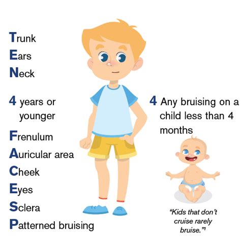 TEN-4 FACES P: A Mnemonic to Help You Spot Signs of Child Abuse - ACEP Now