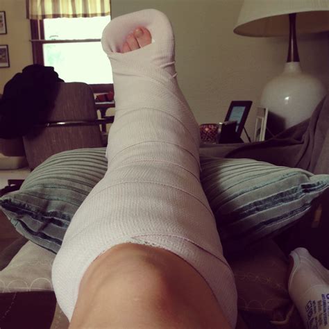 Lisa Living Well: Ankle surgery and the start of healing