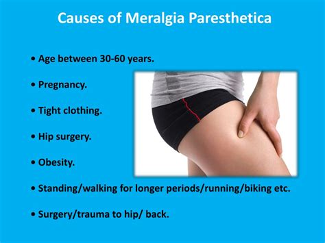 Meralgia Paresthetica Symptoms