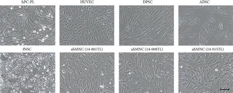 Expression of pericyte markers in ahMNCs. (a) Morphologies of cell ...