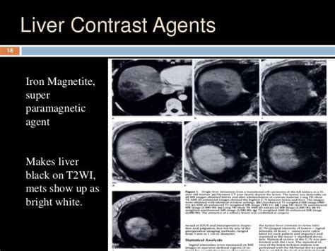 Mri contrast