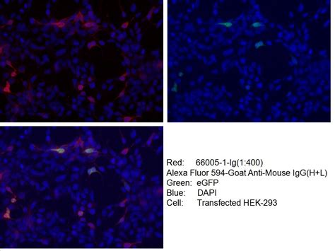 His-Tag Antibody (66005-1-IG)