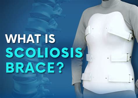 Scoliosis Braces: Can Scoliosis be Corrected with a Brace? - Turan&Turan