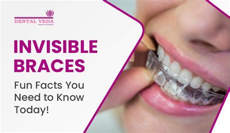 Invisible Braces: Fun Facts You Need to Know Today!