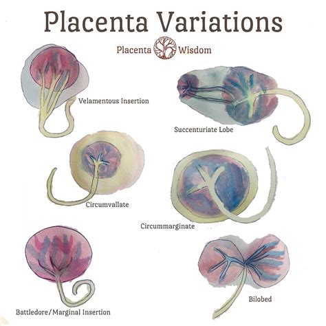 "Placenta Variation Watercolour Drawings" by placentawisdom | Redbubble