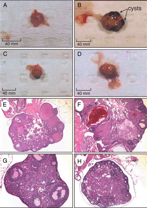 ER is required for the development of hemorrhagic and cystic follicles ...