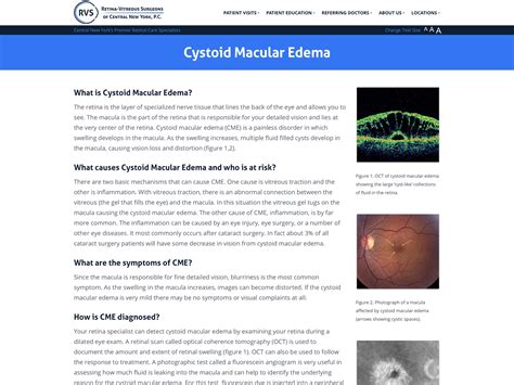 Cystoid Macular Edema - Retina-Vitreous Surgeons of CNY