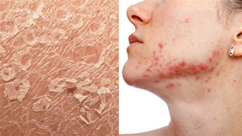 Dermatologists Reveal 5 Signs of Stressed Skin (And How to Heal It)