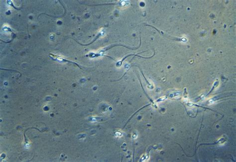 What Does Sperm Motility Mean?