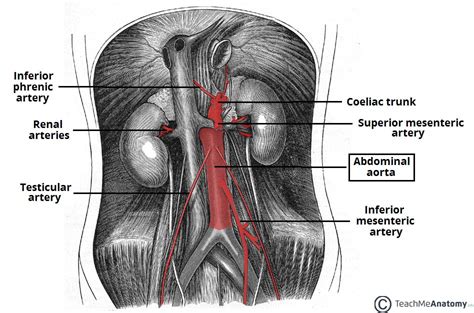 Abdominal Aortic Aneurysm - Clinical Features - TeachMeSurgery