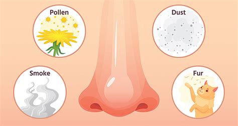 Allergic rhinitis: The symptoms, causes and latest treatment options | BusinessMirror