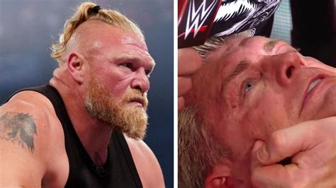 Brock Lesnar injury: How many stitches did Brock Lesnar get on his forehead? Aftermath of brutal ...