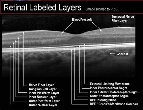 Dekalb Optometric | Anatomía del ojo, Anatomia ocular, Optometría