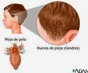 Eliminar Piojos y Liendres ~ El Cuidado de la Salud