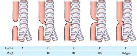 Esophageal Atresia – The Operative Review Of Surgery