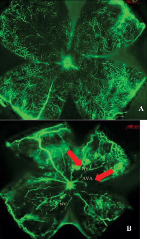 Fluorescein isothiocyanate-dextran (FITC) perfusion of the retinal ...