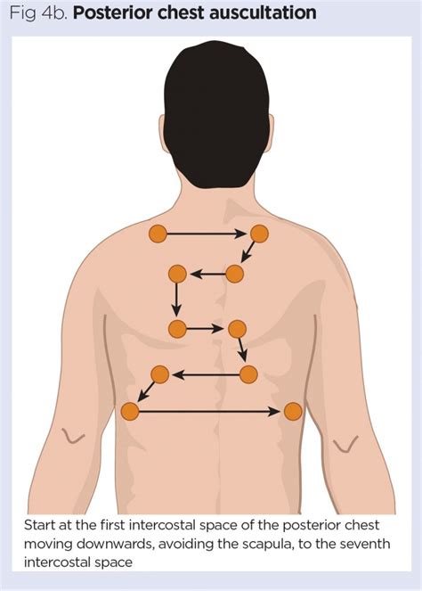 How to perform chest auscultation and interpret the findings - Nursing Times