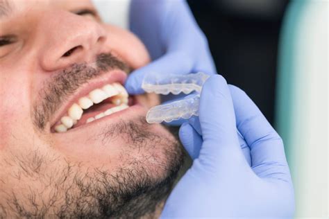 What Are The Best Invisalign Providers And Why It Matters - Harcourt Health