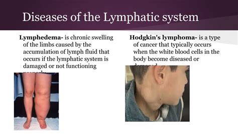 PPT - Lymphatic System PowerPoint Presentation, free download - ID:2701848