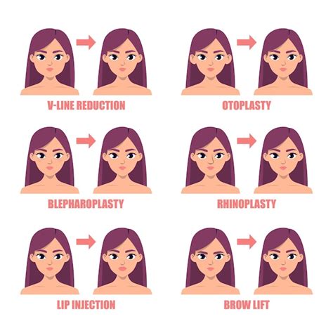 Premium Vector | Types of plastic surgery on the face