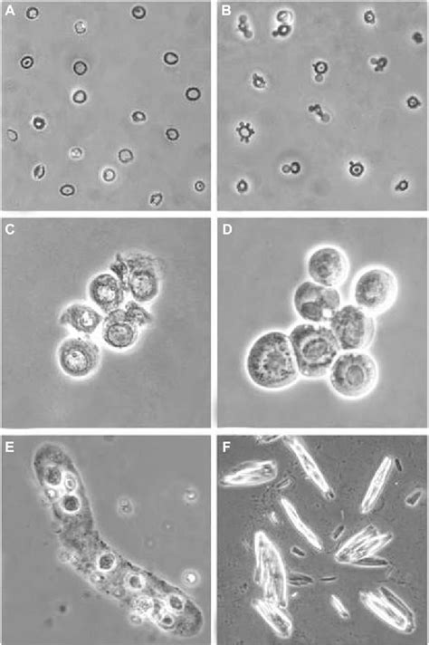 Figure 1 from How to improve the teaching of urine microscopy | Semantic Scholar