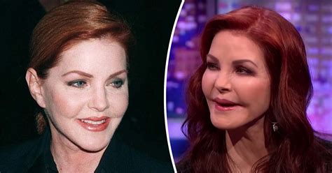 How Priscilla Presley, 77, had plastic surgery procedure gone wrong: Inside her life