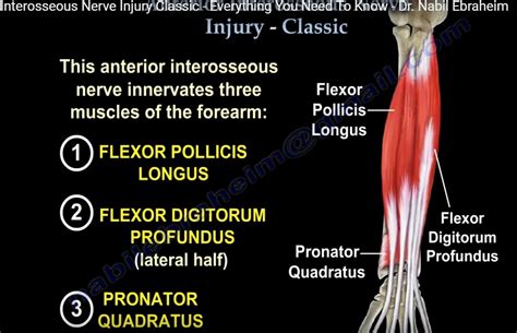 Anterior Interosseous Nerve Palsy — OrthopaedicPrinciples.com