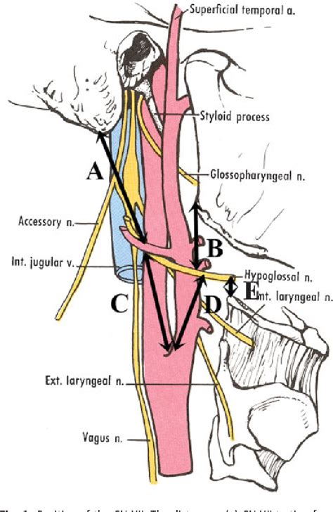 Surgical Anatomy of the Cervical Part of the Hypoglossal Nerve ...