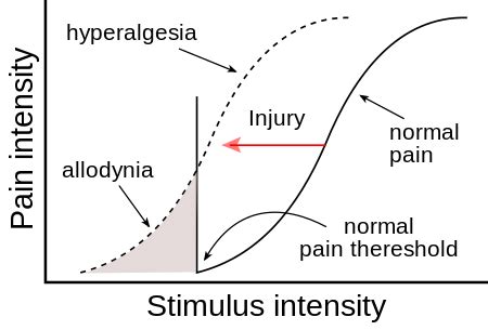 Allodynia - Wikiwand