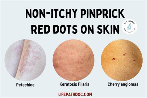 Pinprick Red Dots on Skin, But Not Itchy: Causes, Pictures