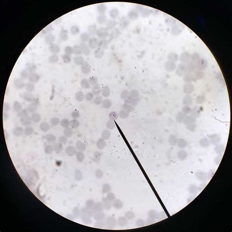 Plasmodium falciparum with gametohyte smear prepared microscope slides