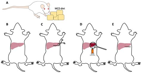 MPs | Free Full-Text | Establishment of Orthotopic Liver Tumors by Surgical Intrahepatic Tumor ...