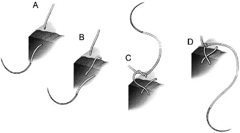 Placement of the figure-of-eight stitch as an anchor. The... | Download ...