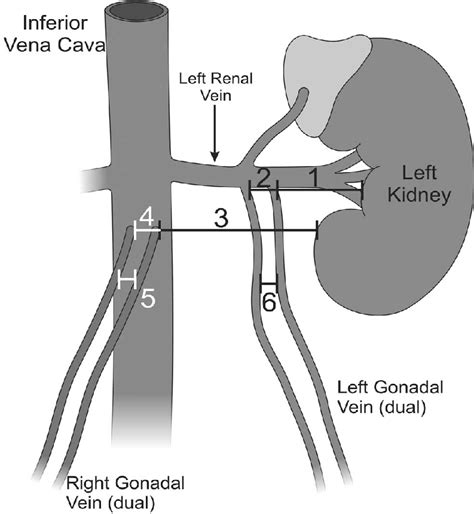 Gonadal Vein Anatomy