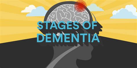 Stages Of Dementia Timeline Check more at http://www.nhprimecare.org/stages-of-dementia-timeline/