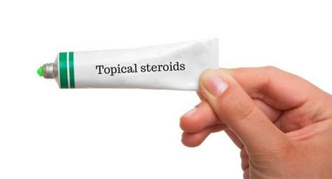 7 horrible side effects of topical corticosteroids or steroid creams ...