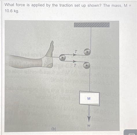 Solved What force is applied by the traction set up shown? | Chegg.com