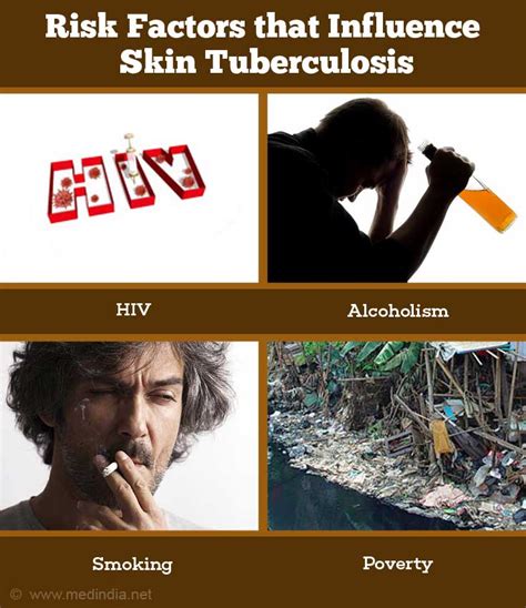 Skin Tuberculosis - Causes, Symptoms, Diagnosis, Treatment & Prevention