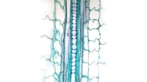 ‎Protoxylem and metaxylem vessels in longitudinal section of Zea stem ...