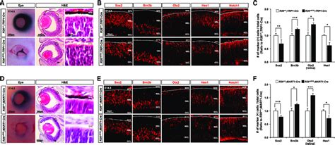 The RPE Cells Play Roles in RPC Maintenance (A) RPE was selectively... | Download Scientific Diagram