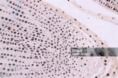 Mitosis Cell In The Root Tip Of Onion Under A Microscope Stock Photo - Download Image Now - iStock