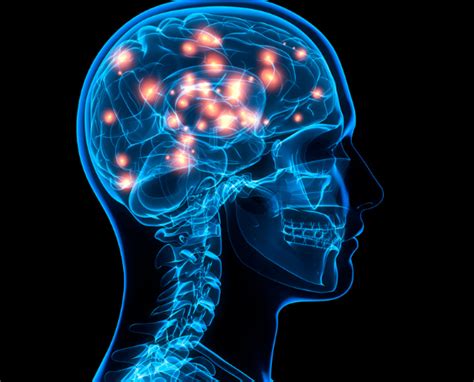 Understanding Neuromyotonia: Causes, Symptoms, and Treatments - Medichimp