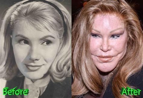 Catwoman Plastic Surgery: From Bad To Worse