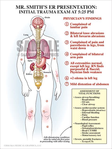 Cervical Injury Stabilization - S&A Medical Graphics