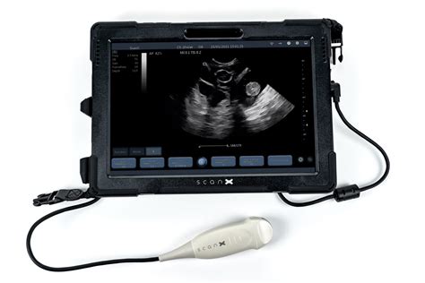 ScanX - Portable Ultrasound Machines